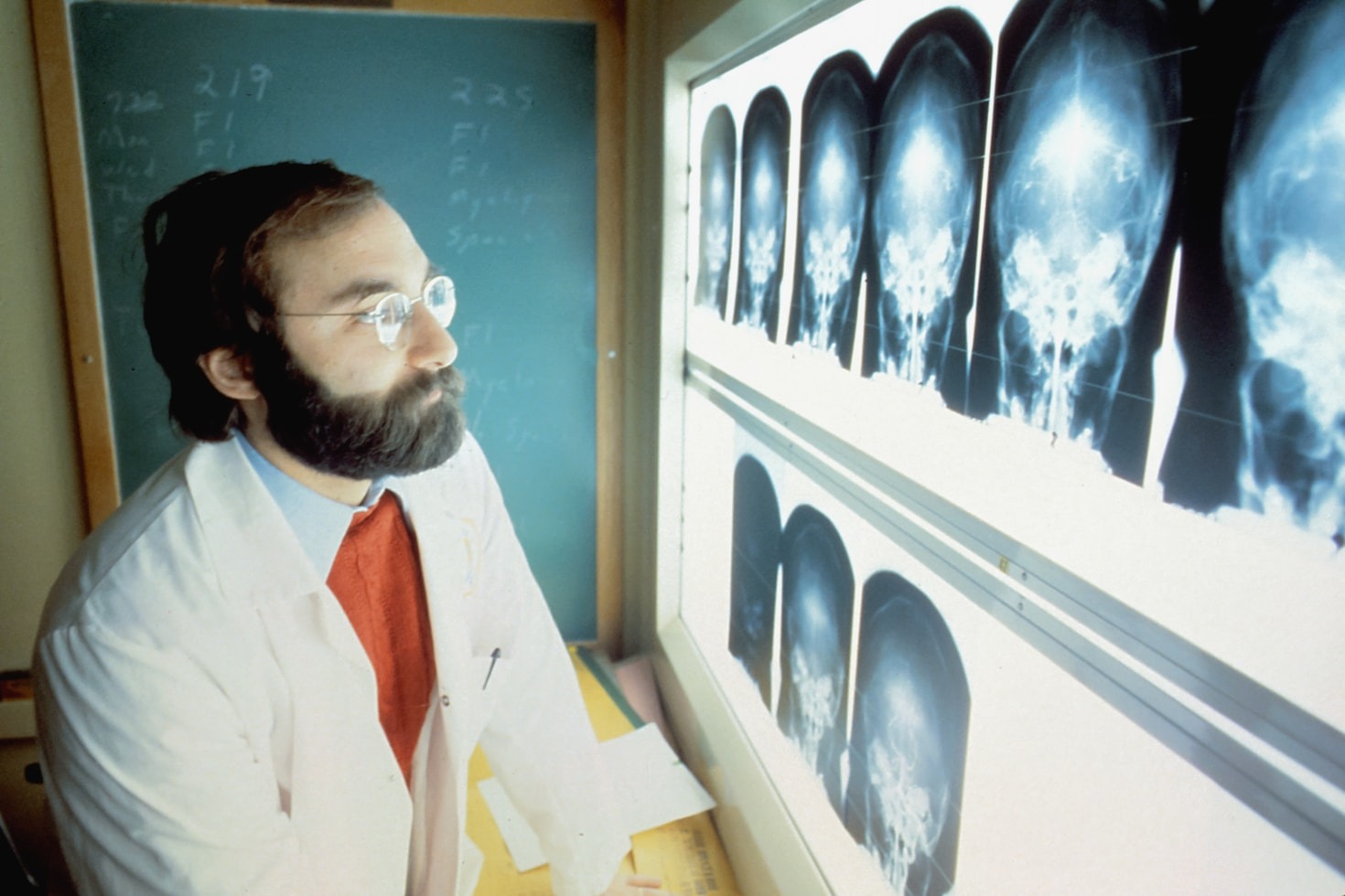 The Future of Radiology with Artificial Intelligence