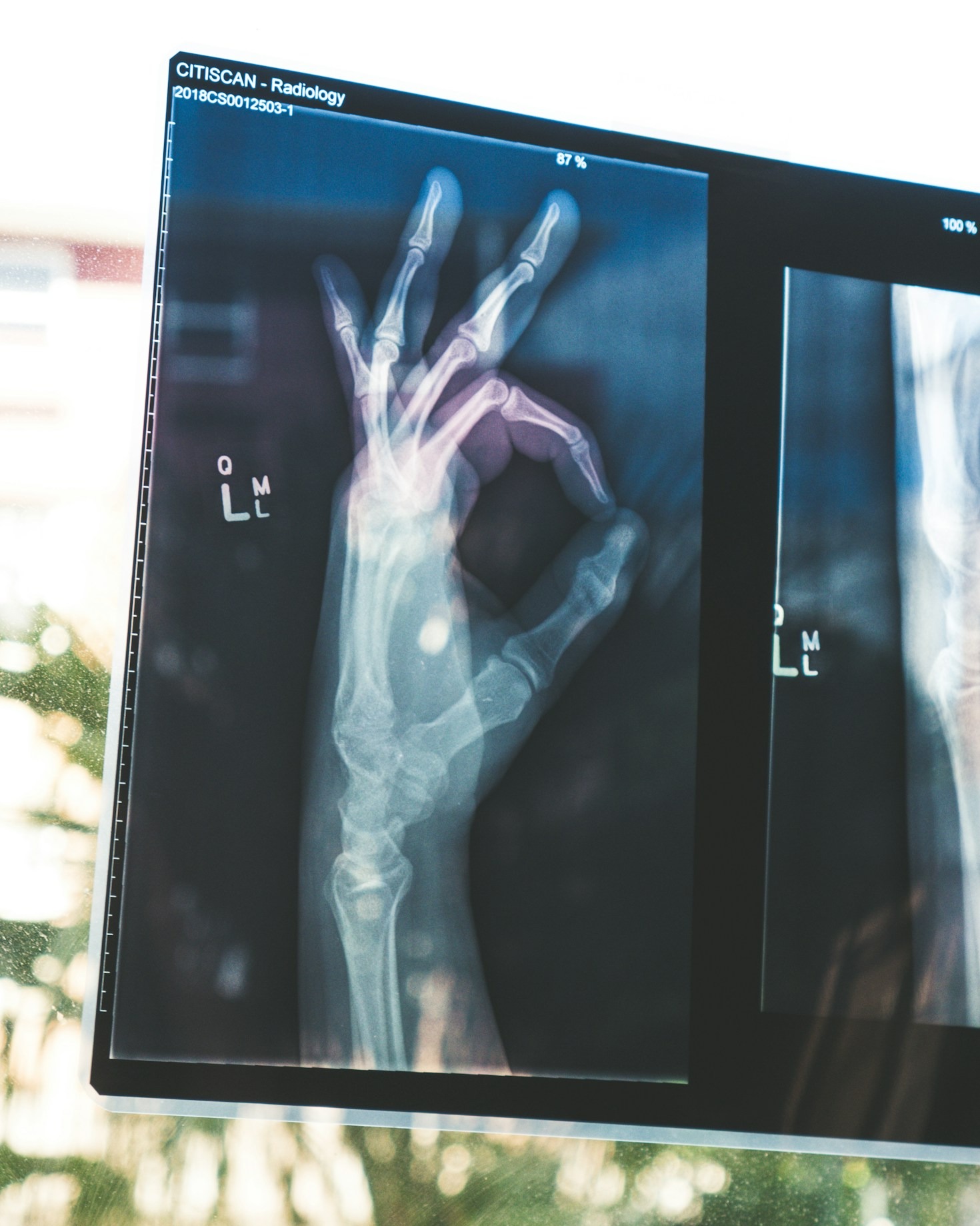 Breaking Down Barriers in Diagnosis with AlRazi